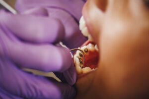 Pinole AAO Member Orthodontist