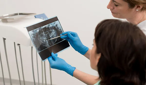 Understanding Malocclusion: What It Is and How Orthodontics Can Help