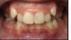 before images