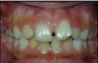 before images