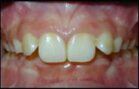 before images